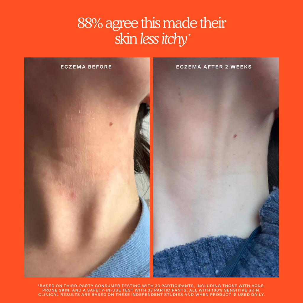 SOS Rescue + Relief Body Wash Treatment